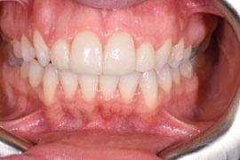 ortodonzia