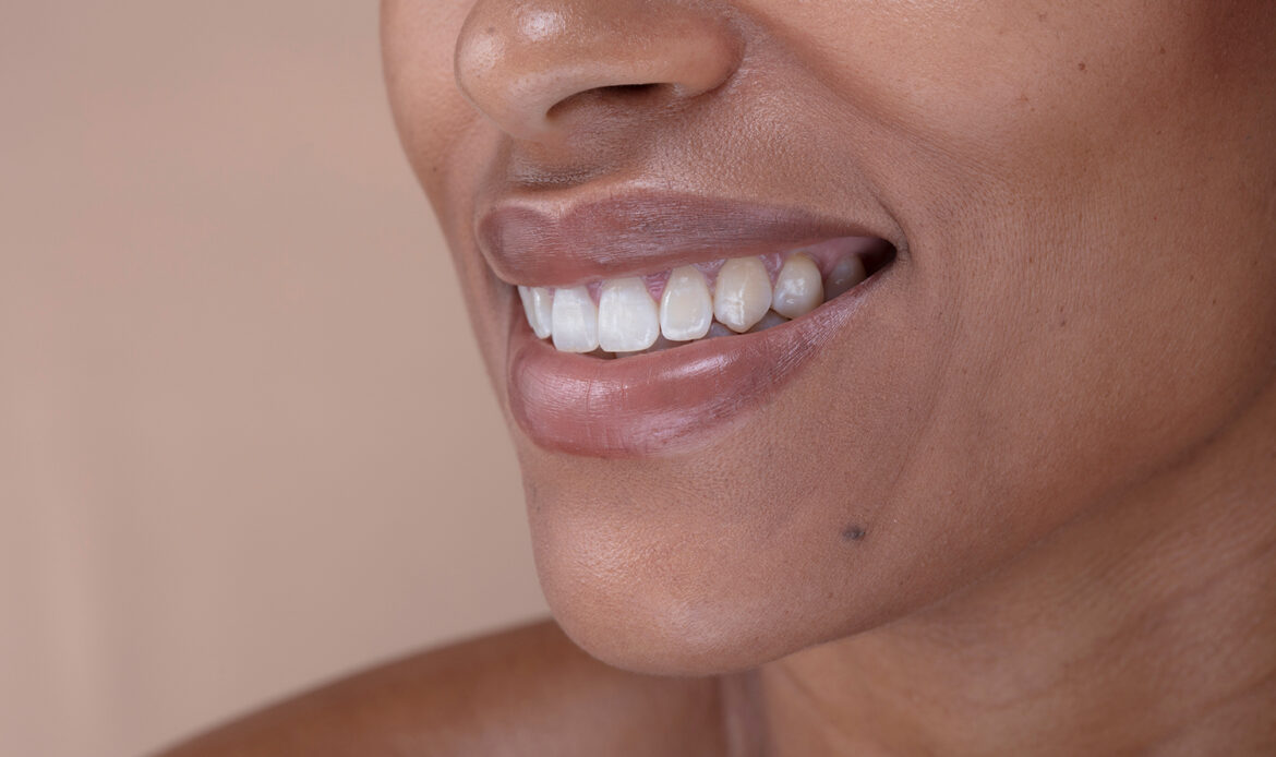 estetica dentale milano centro dentistico ortelli