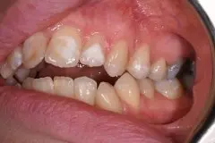 ortodonzia-last